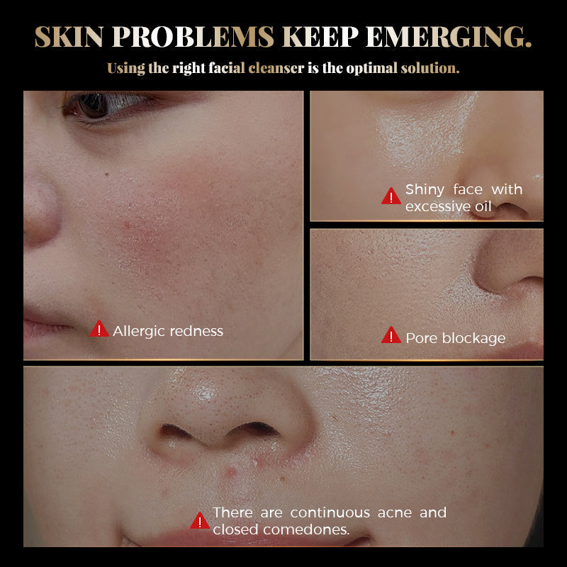 QINGLIN Aminosäure Sanfte Reinigungscreme