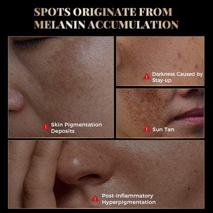 QINGLIN Hanlu Whitening & Spot Removal Cream