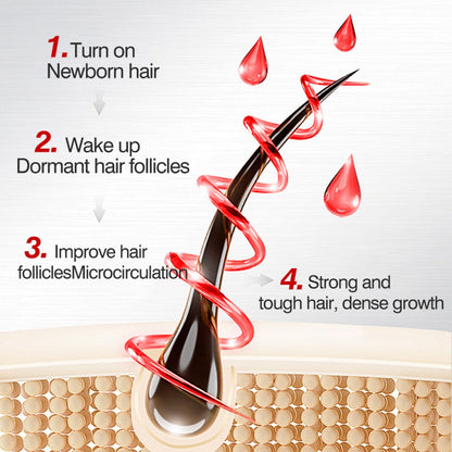 Spray QINGLIN pour la pousse des cheveux