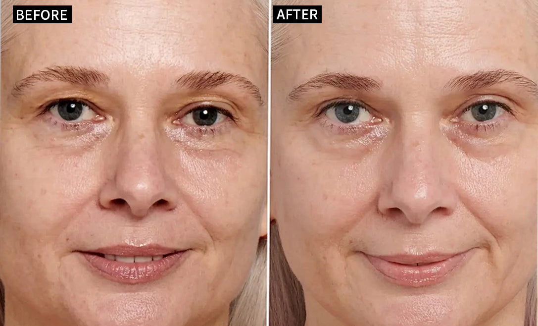 Before and after result