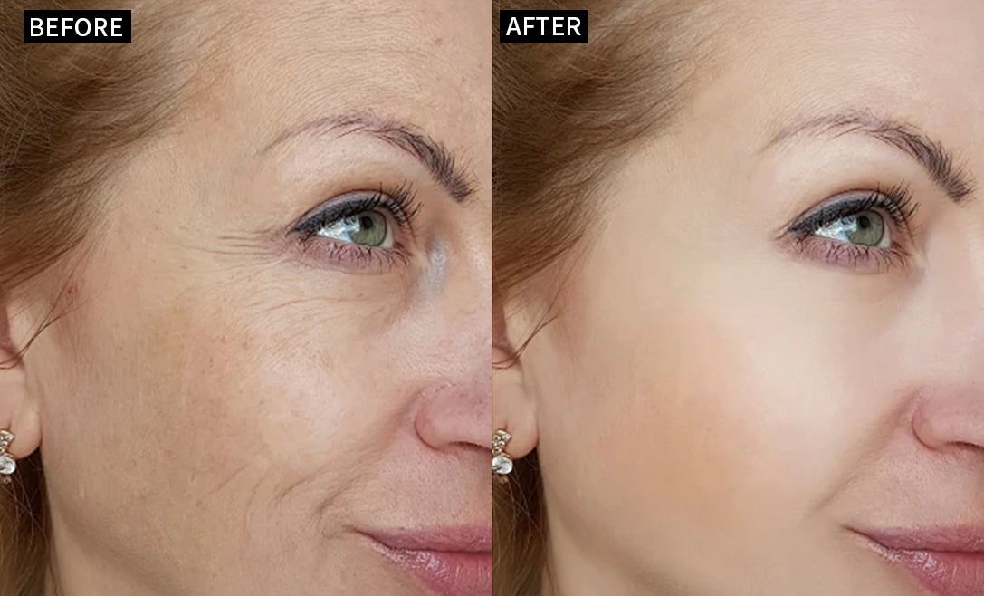 Before and after result