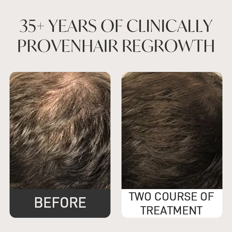 Spray QINGLIN pour la pousse des cheveux