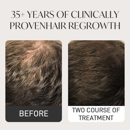 Spray QINGLIN pour la pousse des cheveux