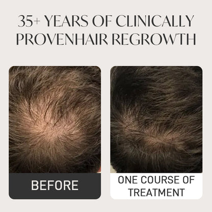 Spray QINGLIN pour la pousse des cheveux